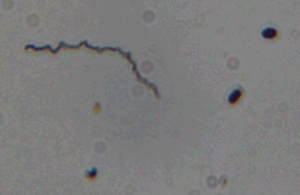 Dieterle silver stain of genital culture from Patient 12. Note darkly staining spirochete. Formalin fixed slide, 400× magnification