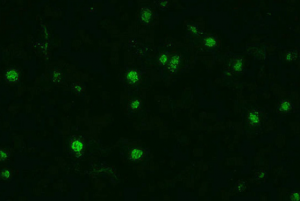 Indirect Fluorescent Antibody Test